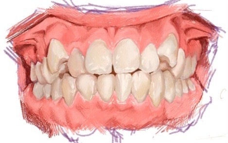Dental Study